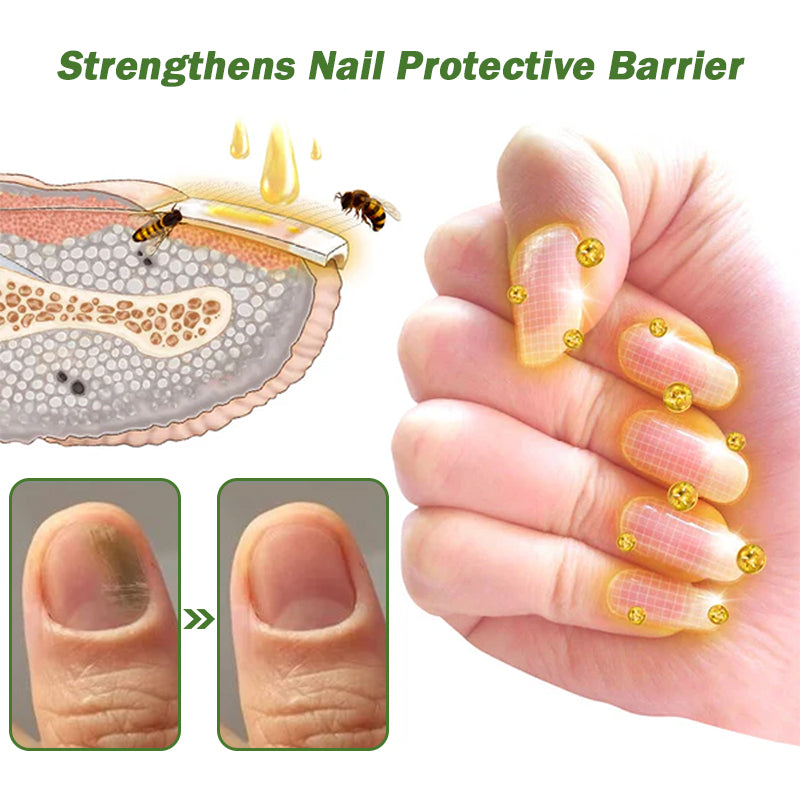 Kolirin Nail Defense Bee Venom Treatment Serum