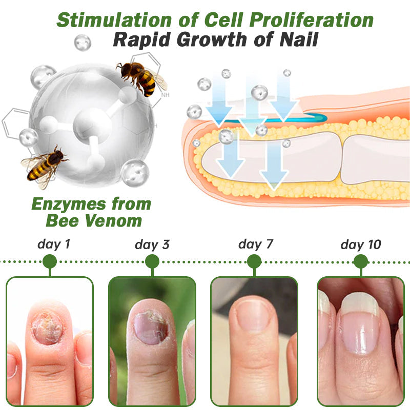 Kolirin Nail Defense Bee Venom Treatment Serum