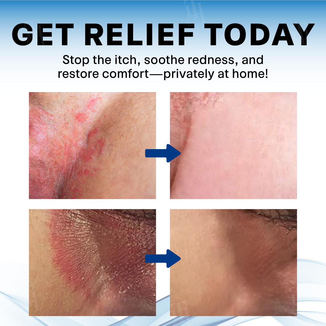 Scrotum Itchy Treatment Cream PRO