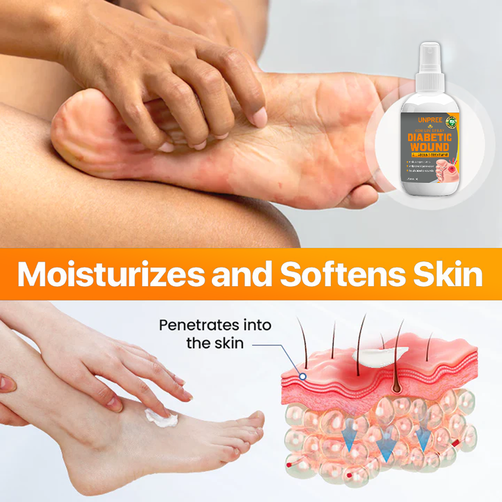 💥 2025 Limited 70% OFF ️⏳ Kolirin Diabetic Wound Spray 💥 Fix Diabetic Wounds 100% in 2 Weeks