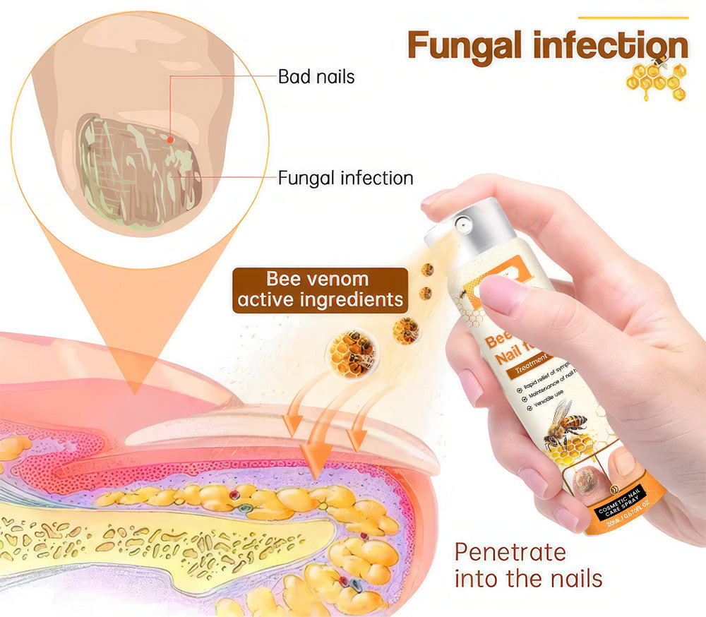 💥 2025 Limited 70% OFF ️⏳ Kolirin Bee Venom Nail Fungus Spray 💥 Fix All Nail Problems within 2 Weeks