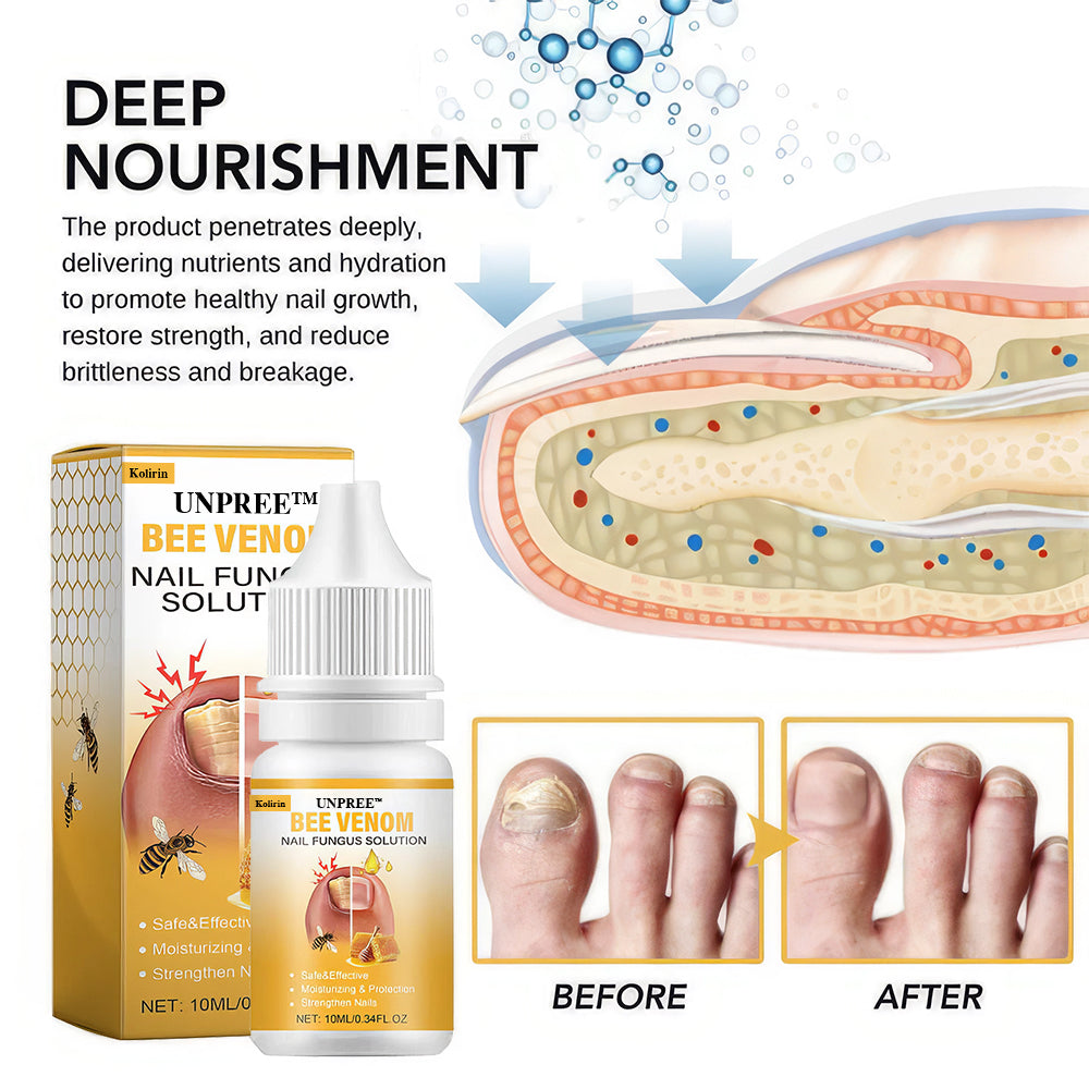 Kolirin BeeVenom Nail Fungus Solution