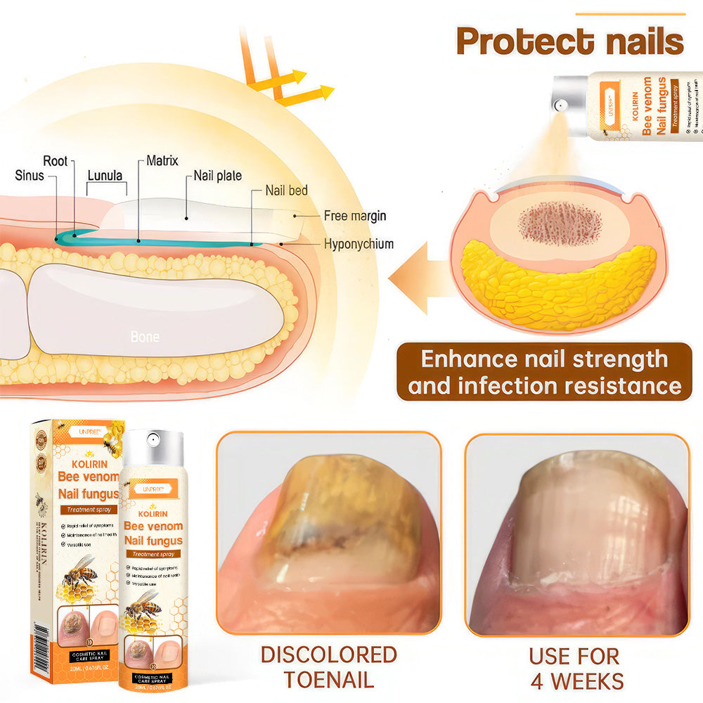💥 2025 Limited 70% OFF ️⏳ Kolirin Bee Venom Nail Fungus Spray 💥 Fix All Nail Problems within 2 Weeks
