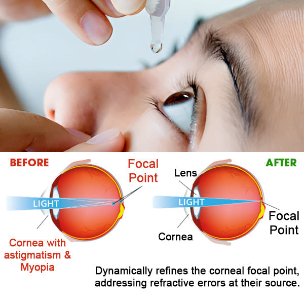 š„ 2025 Limited 70% OFF ļøā³ Kolirin Eye Care Drops
