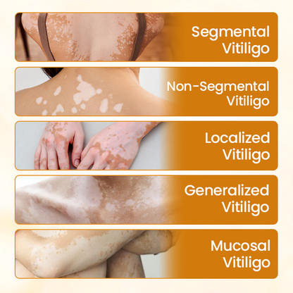 VitiCalm Bee Venom Cream